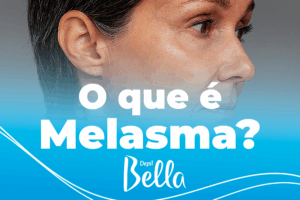 OQUE E MELASMA