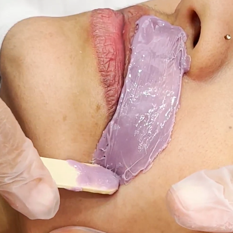 Remova com Precisão: 