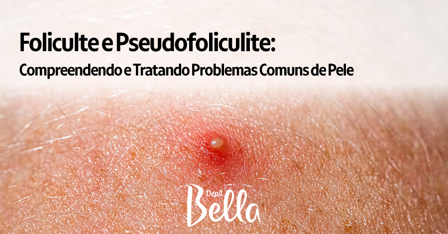 Foliculte e Pseudofoliculite: Compreendendo e Tratando Problemas Comuns de Pele